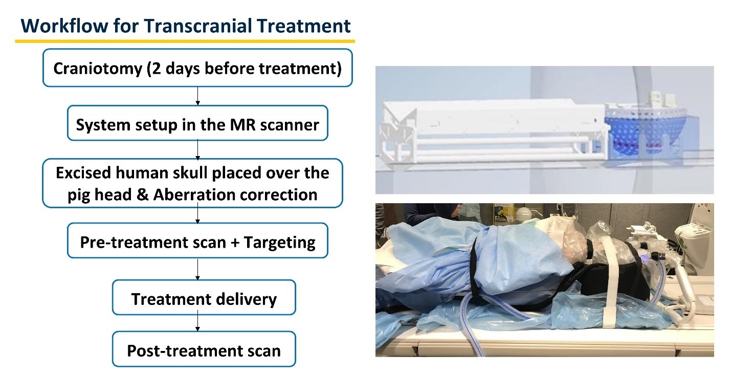 Workflow for transcranial treatment slide